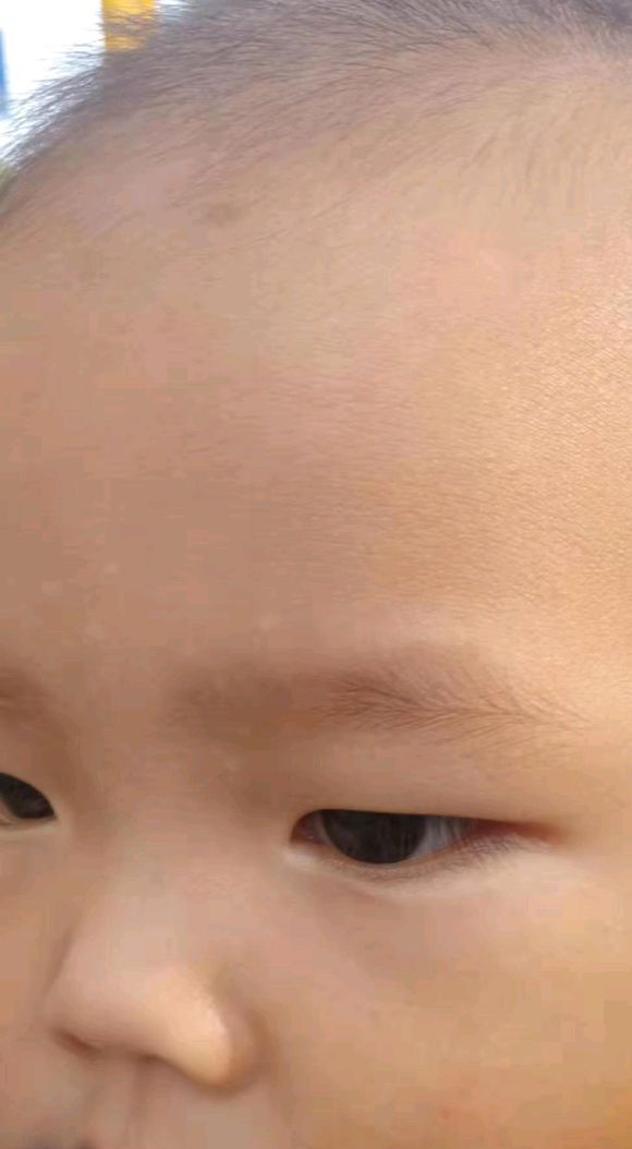 额头上有一些小白点，最近发现宝宝额头上有了这样的白点，是不是