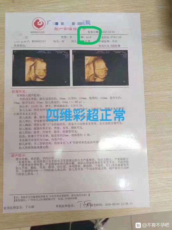 四川客户M姐 45岁 头胎志愿者孕6个月孕检系统大排畸检查四