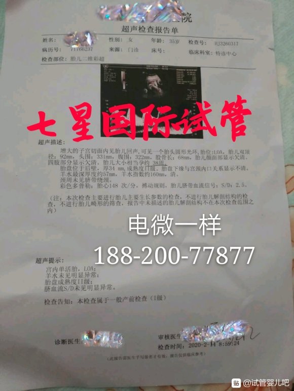 恭喜南宁二胎家庭成功怀上男孩，38周孩子很快生了
