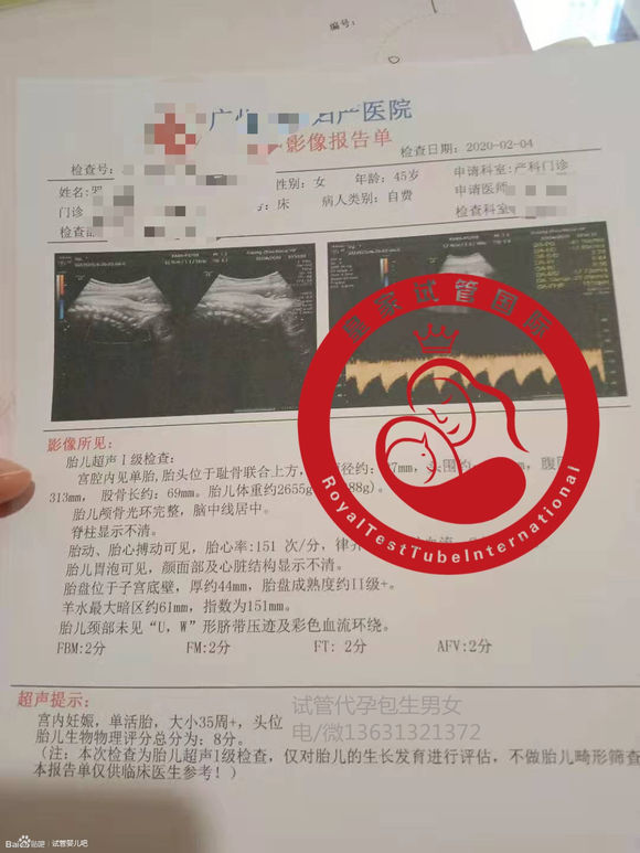 试管前女方