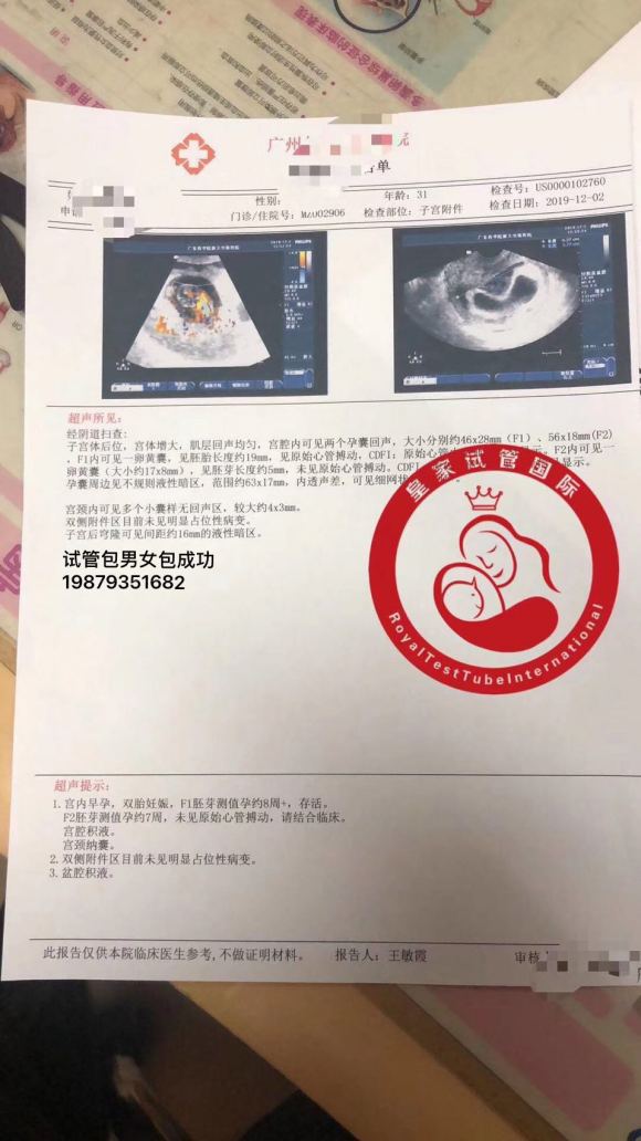 “积极备孕”还是“顺其自然”?备孕到底有没有必要？