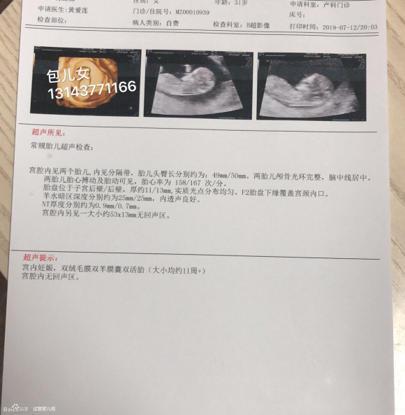 什么年纪是生育能力，80岁有精还可以吗？
