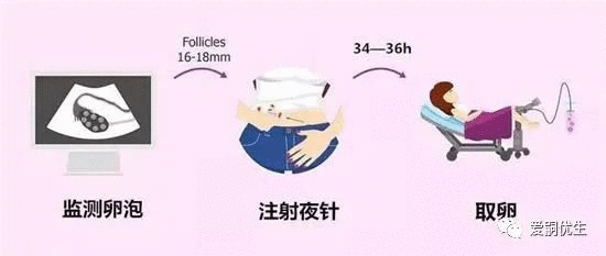 试管婴儿什么是夜针？应该什么时候打呢？