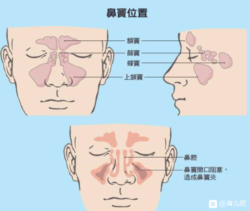 （精华）（原创）孩子腺样体肥大，鼻窦炎保守治疗