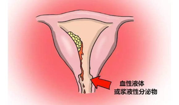 徐州不孕不育研究院：月经规律 ≠ 排卵正常=怀孕，不要再误解
