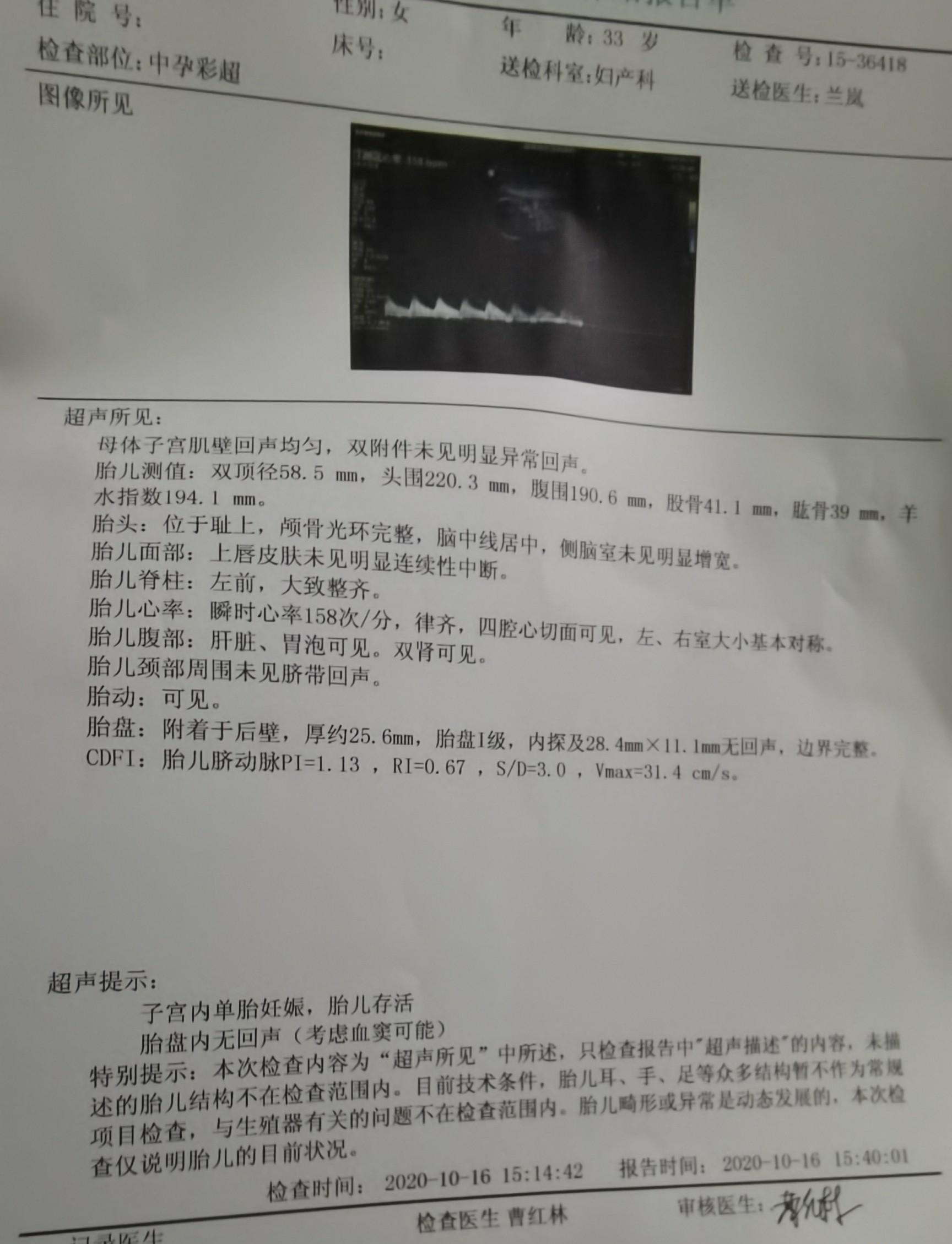二胎宝宝今天大排畸