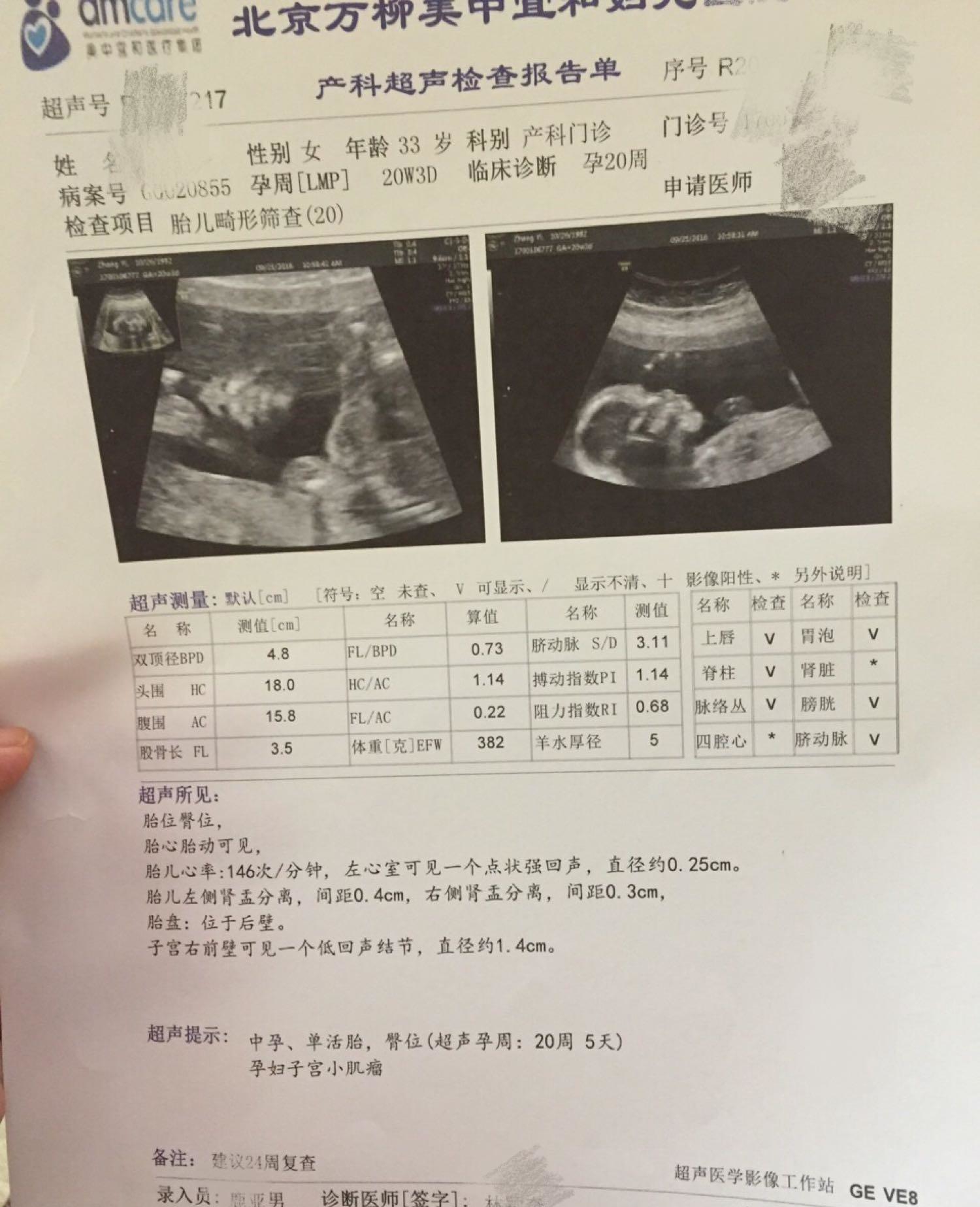 确定二胎男宝一枚，附图和症状