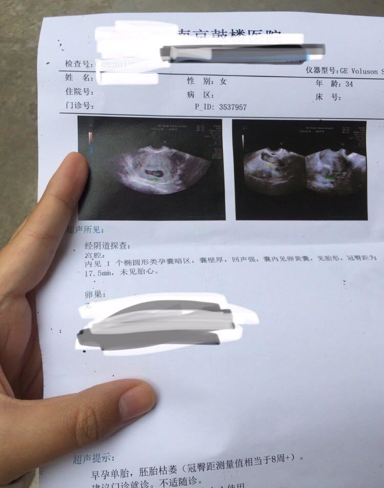 二胎移植了三次