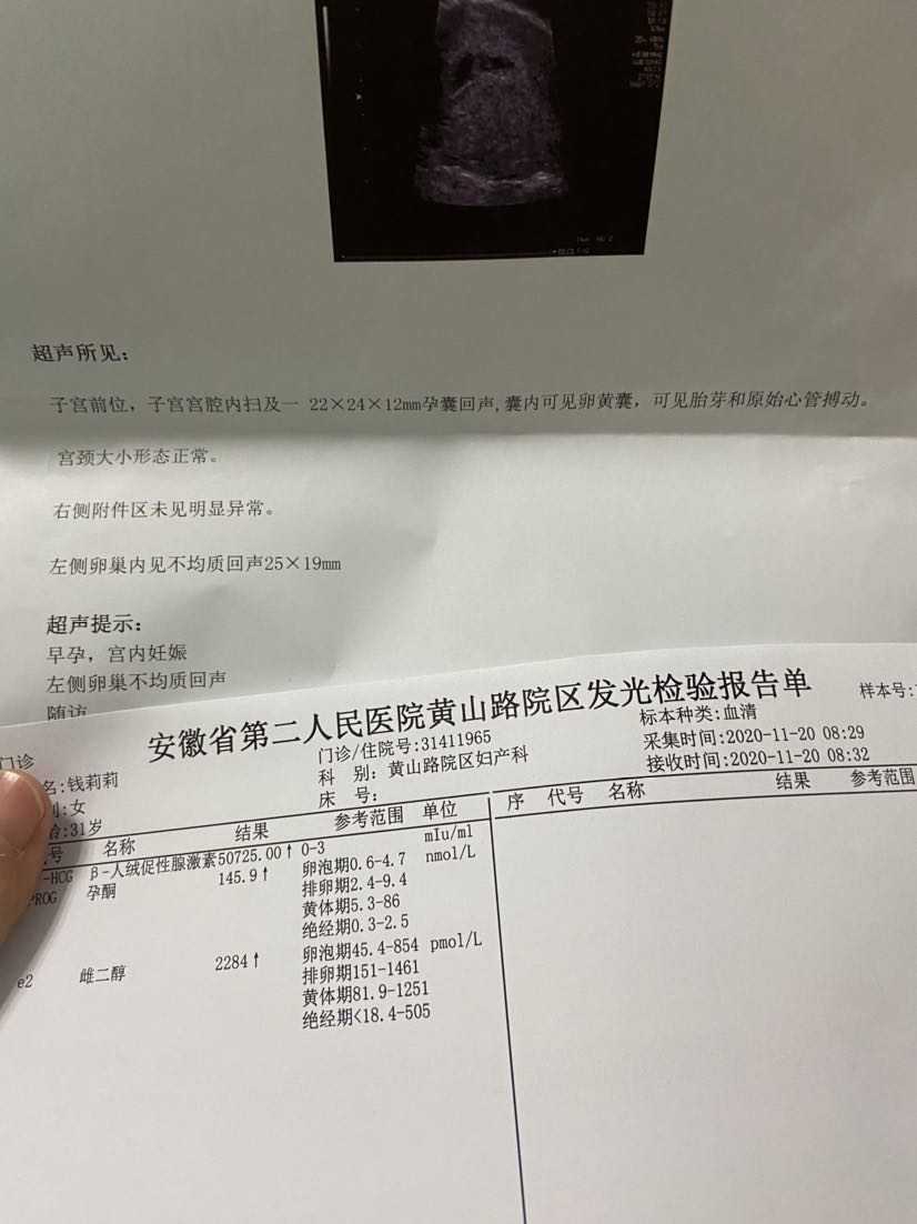 之前讲过打死不生二胎的人，二胎生涯开始了…