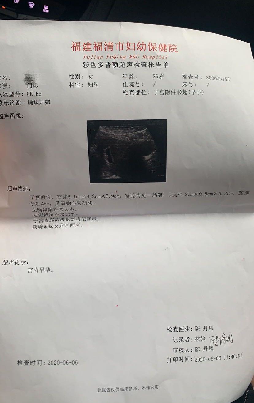 二胎，希望如愿，儿女双全，看胎囊猜男女，娱乐一下