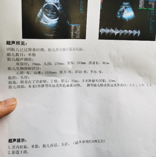 二胎临近开奖，整天神经兮兮的