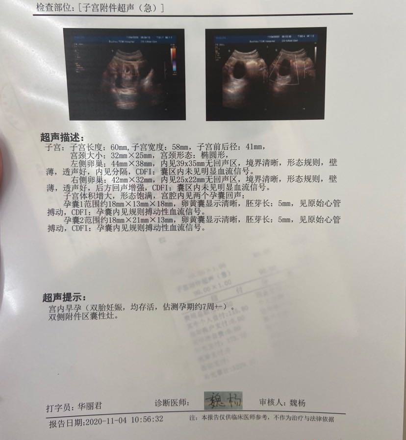 二胎妈妈男宝女宝孕期特征分享
