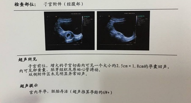 43岁高龄追二胎，半年好孕！分享经验总结！