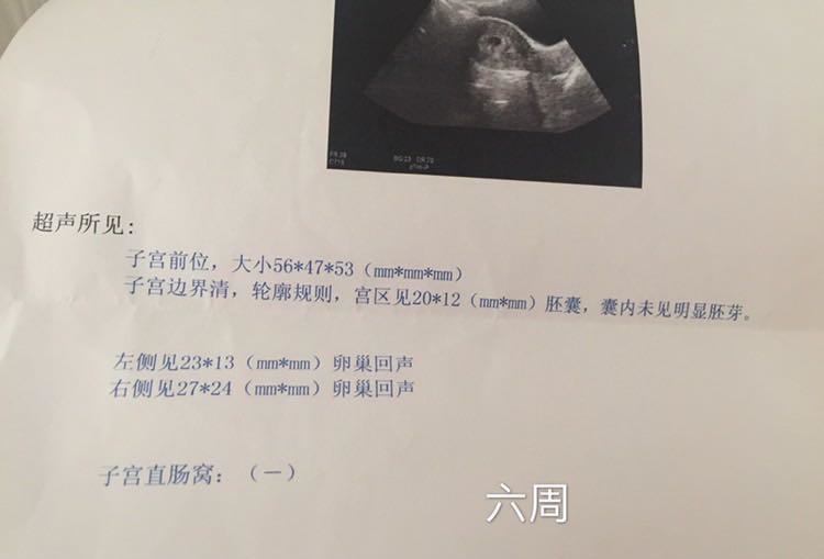 二胎凑成好字，附孕期详细症状