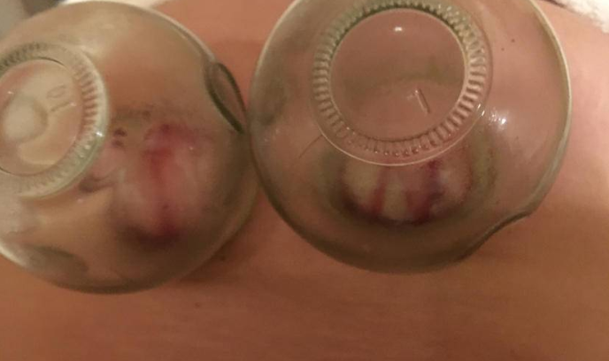 高龄试管，怎样才能改善子宫内膜血流？