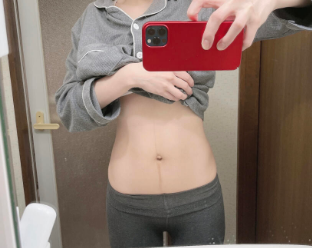 二胎产后25天的肚子～