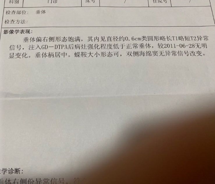 原发性早衰闭经到生育后的治疗