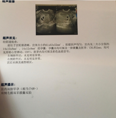 产检报告出来，吓坏了，双胞胎该笑该哭