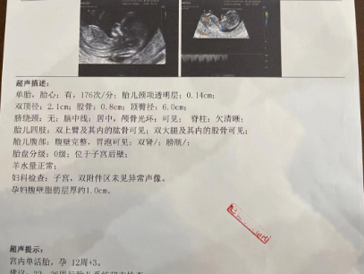 NT秒过，一定要接