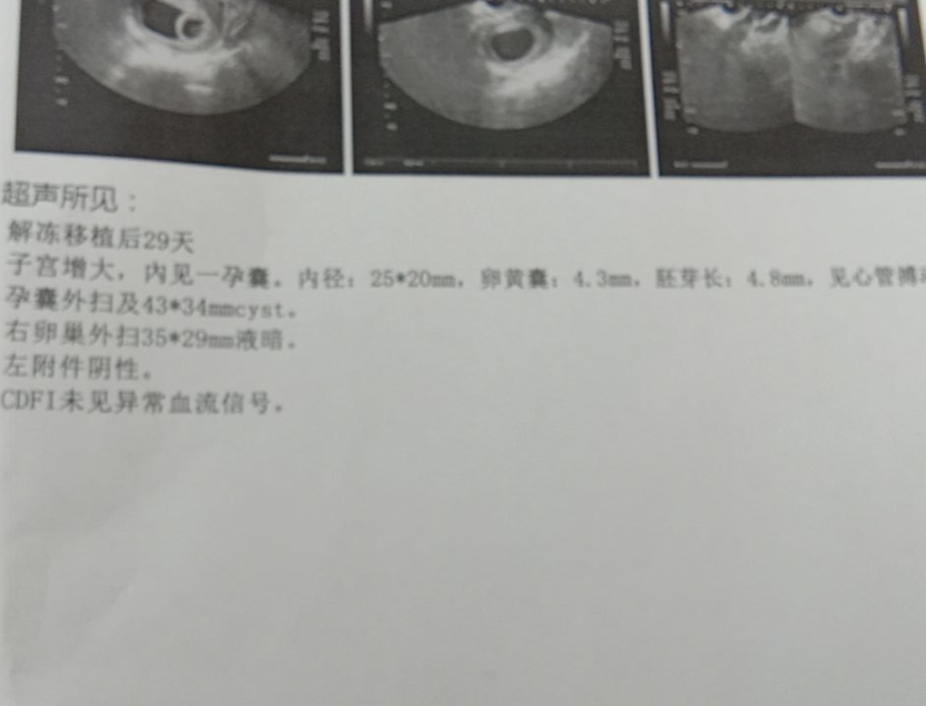 今天移植30天，把昨天做的阴超