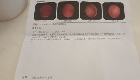宫腔镜，是不是子宫内膜炎