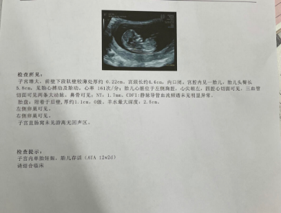 NT秒过后的碎碎念