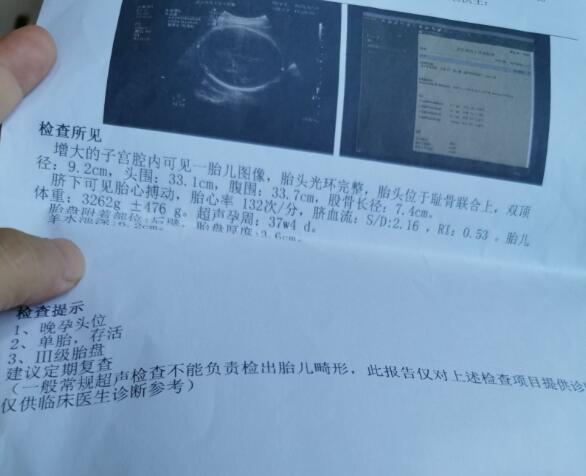 明天剖腹产