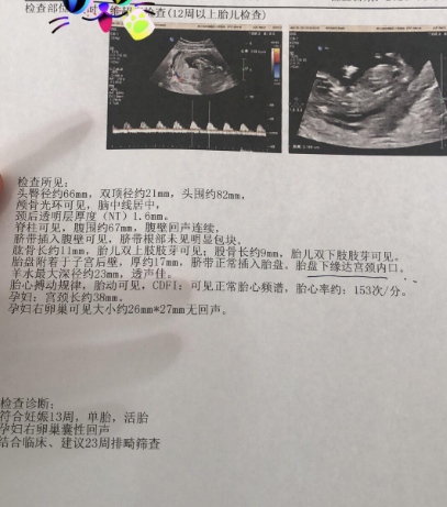 NT通过，产检一路绿灯~