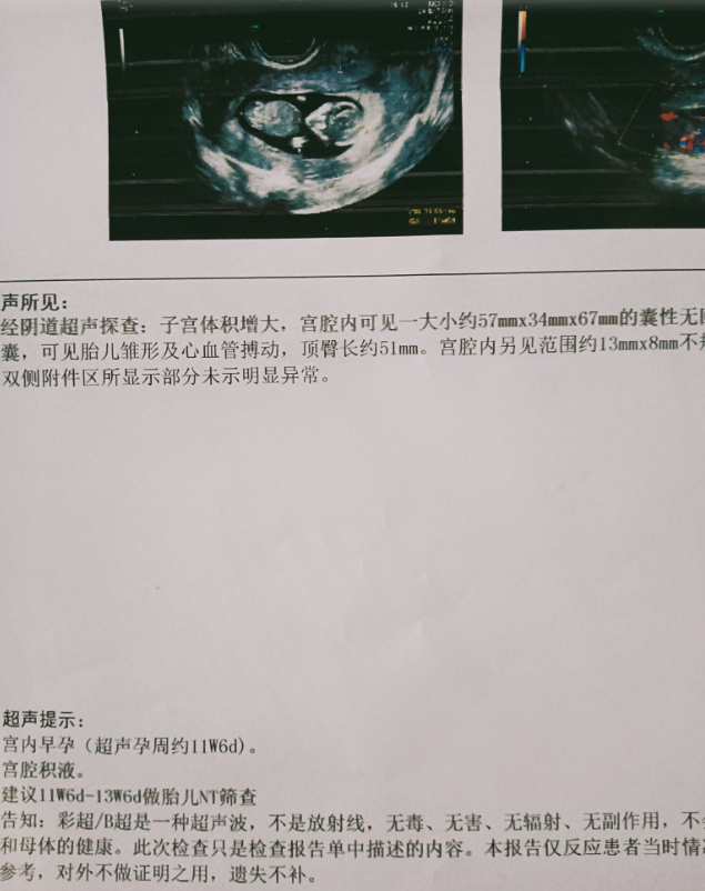 移植第64天