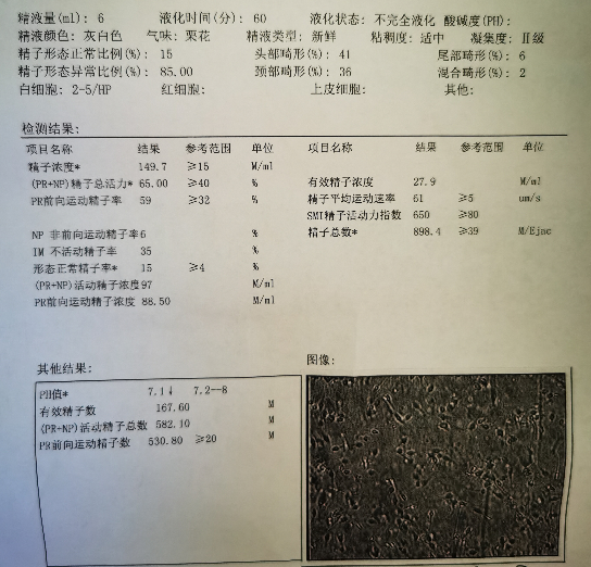 刚做的精液常规检查，有经验的亲帮忙看看