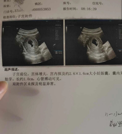 我一胎的时候生了个女宝，现在怀孕二胎
