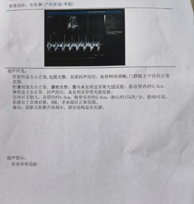 39岁高龄产妇