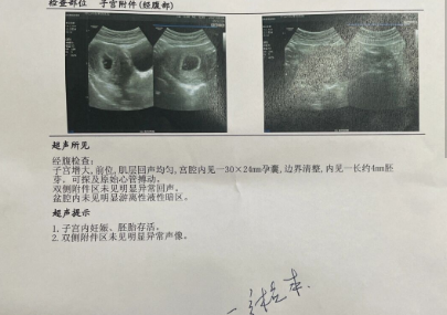 热呼呼的胎心胎芽