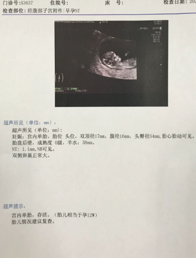 NT秒过！高龄产妇好开心