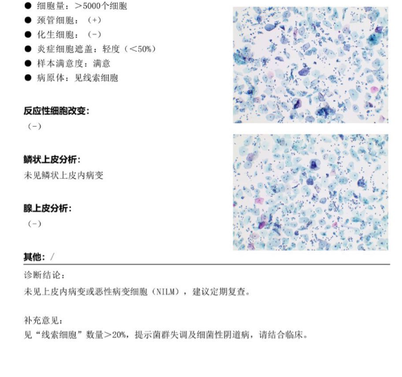 衣原体支原体阳性，姐妹们是怎么治疗的？