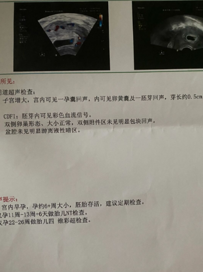 明年四月份的小老虎够备孕了6个月