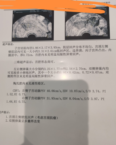 子宫肌瘤太大能不能备孕，有没有同种情况的姐妹
