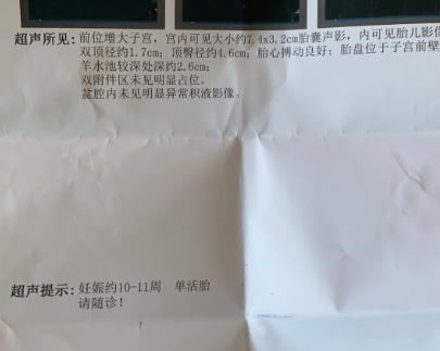 十周+4接好孕接胎心