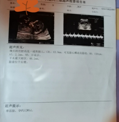 36岁二胎NT顺利通过