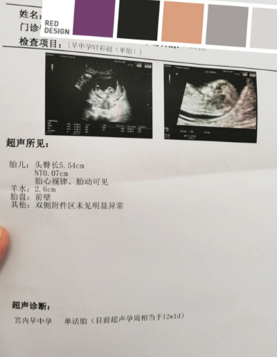 Nt过啦，接好孕