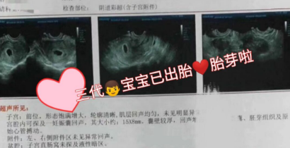 移植成功后的手忙脚乱
