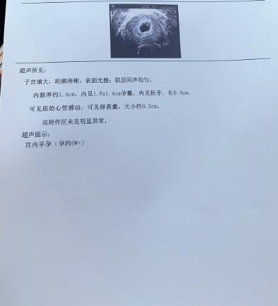 我怀孕了！二胎来啦