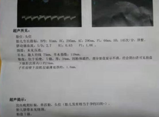 47岁宝妈的特别礼物