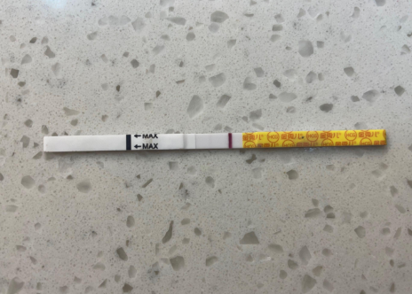 移植的一枚鲜囊胚