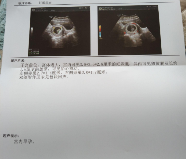 我的崽崽又长大了，好开森