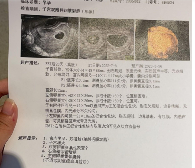 有没有和我一样，一个胚胎分裂了