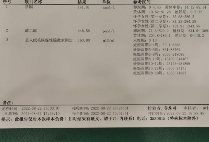 终于开奖了