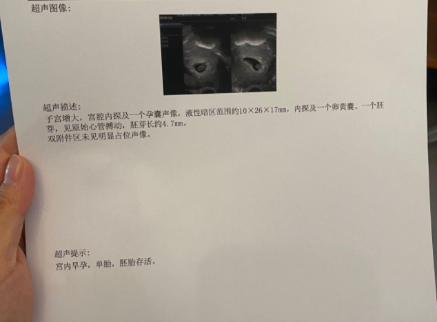 8月2号移植2个囊胚，今天一超开奖成活了1个