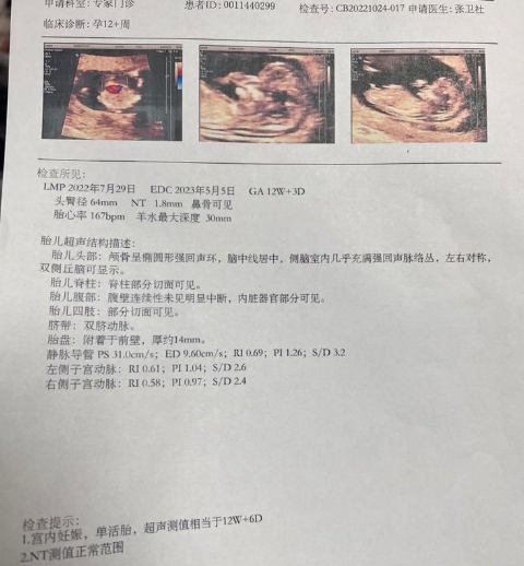 终于迎来了nt顺利通过，快来接好孕