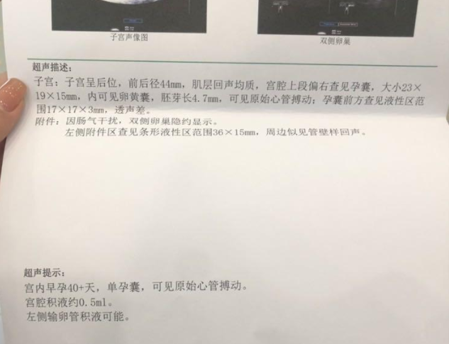 移植第26天，医生说我的孕囊太大，胎芽太小